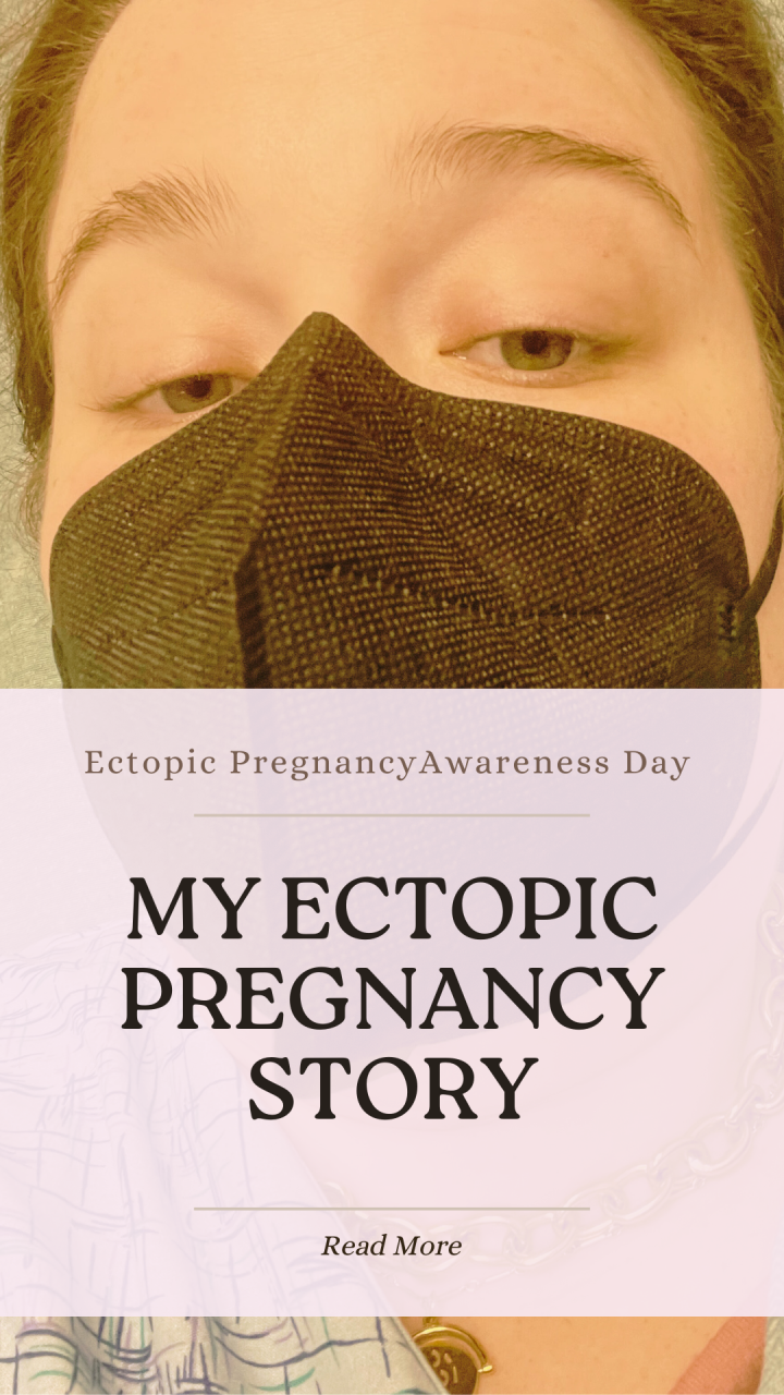 My Ectopic Pregnancy Story